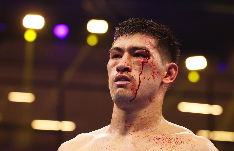 Bivol was cut badly late on, but he marked up Beterbiev’s face throughout the bout (Getty Images)